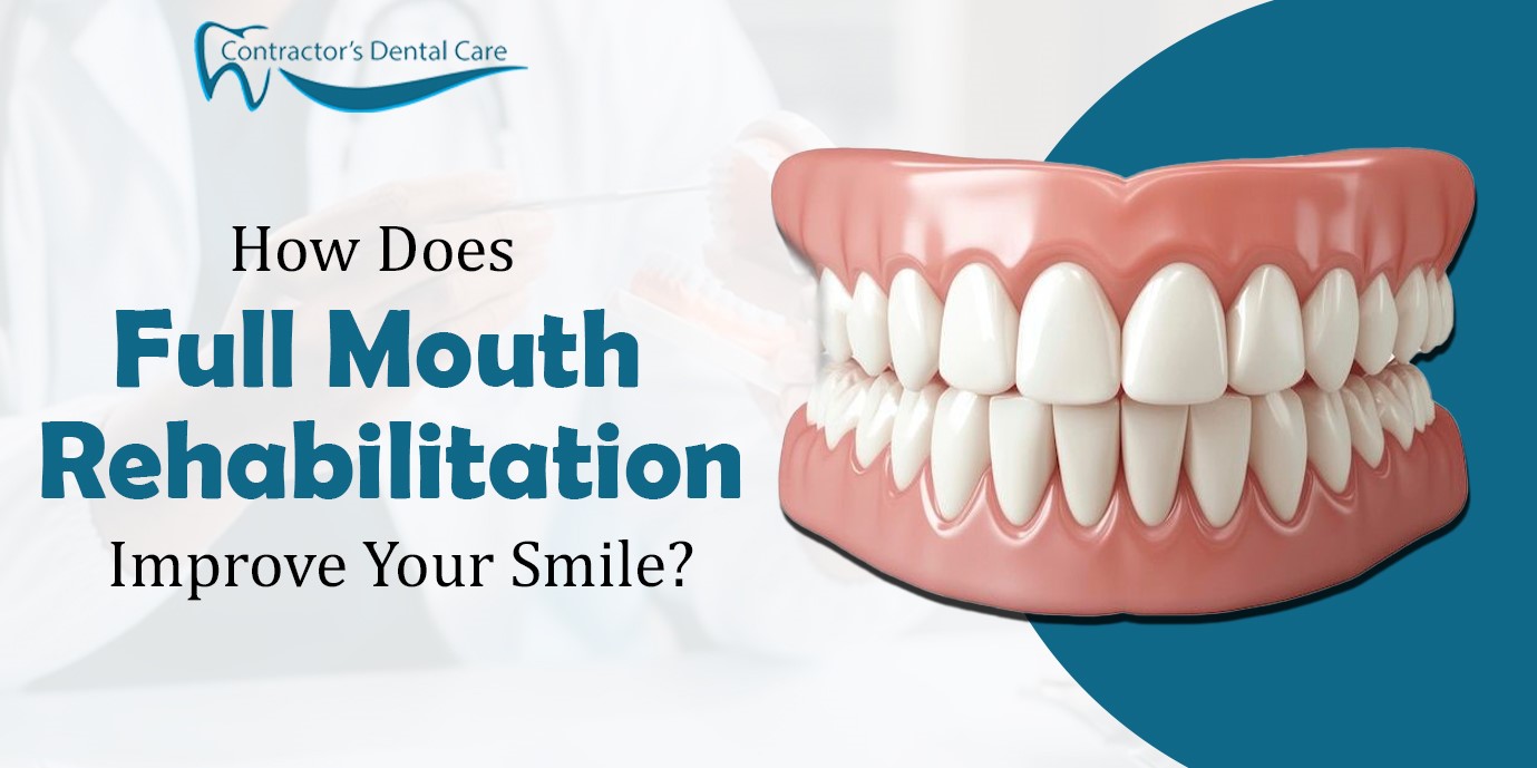 Full Mouth Rehabilitation