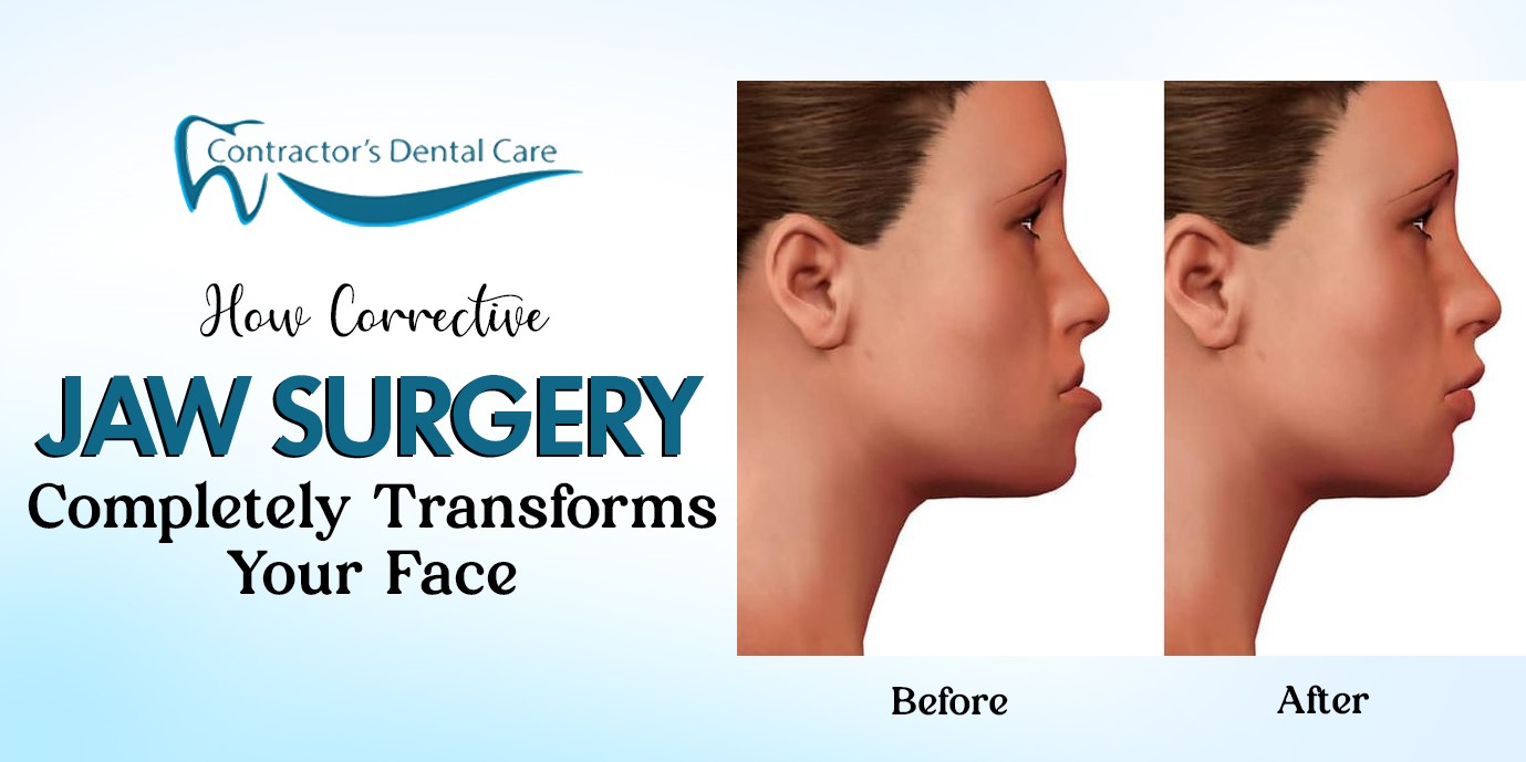 Jaw Surgery 