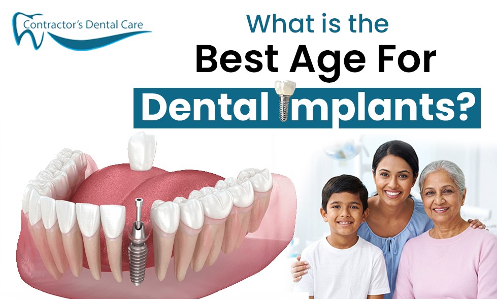 The Best Age For Dental Implants